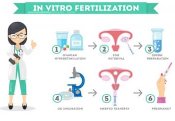 ivf 2 - Everything you need to know about In Vitro Fertilization (IVF) treatment