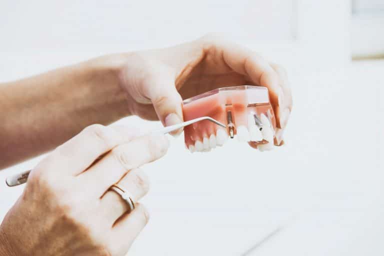 Four Main Types of Dental Implants According to Dentists