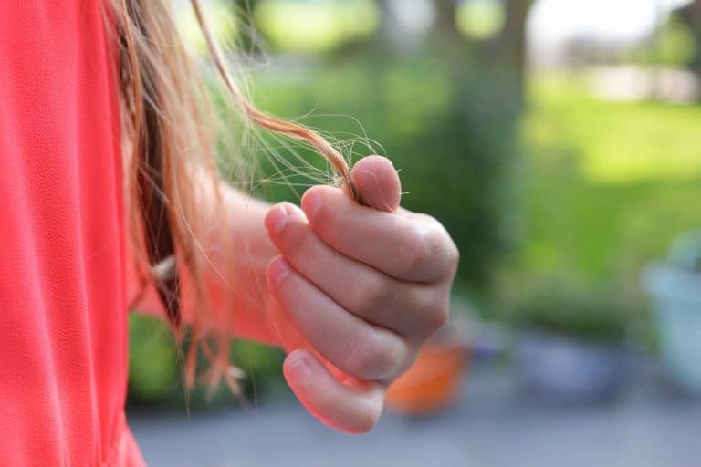 5 Reasons Behind Female Pattern Hair Loss