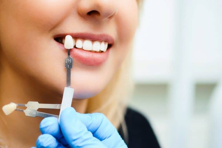 What Your Teeth Can Tell You About Your Overall Health