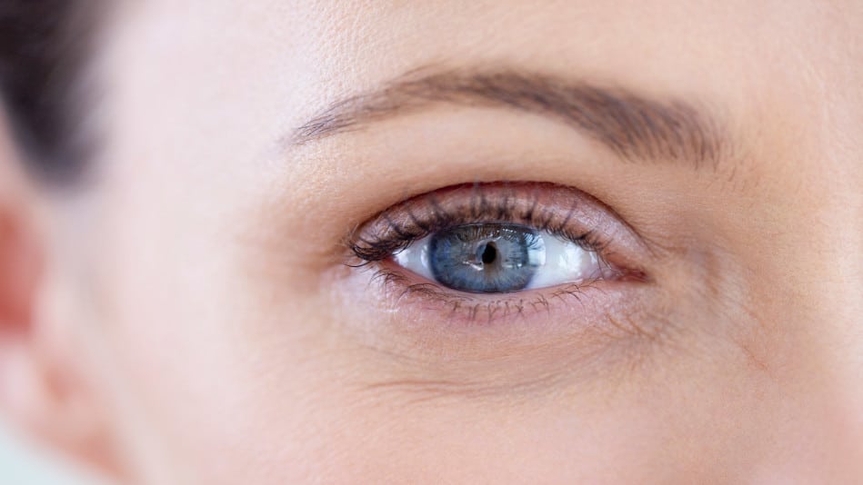 201807 orig eye wrinkles 949x534
