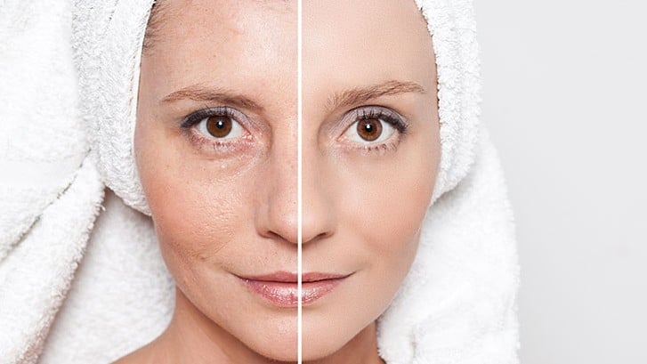 premature facial skin aging 727x409