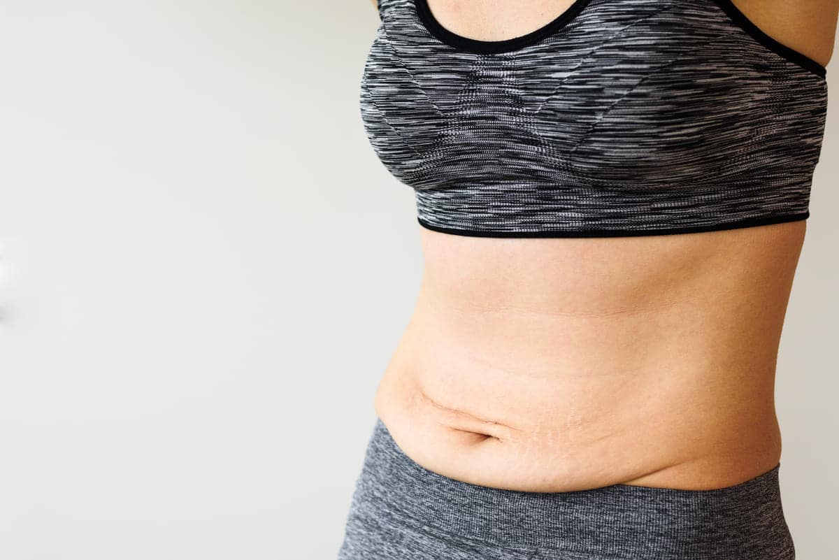 How To Reduce Belly Fat After C Section 11 Effective Tips MOM News Daily