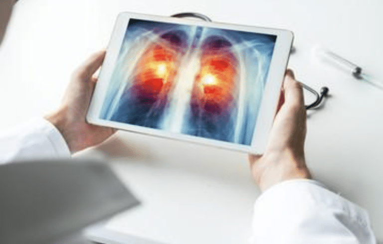 Dr. Sandeep Nayak Gives Tips on How to Avoid Lung Cancer and Save Your Life