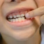 Do Baby Tooth Have Roots? And How They Should Get Pulled