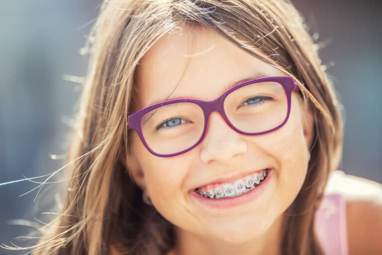 Should Your Teenage Kids Wear Braces?