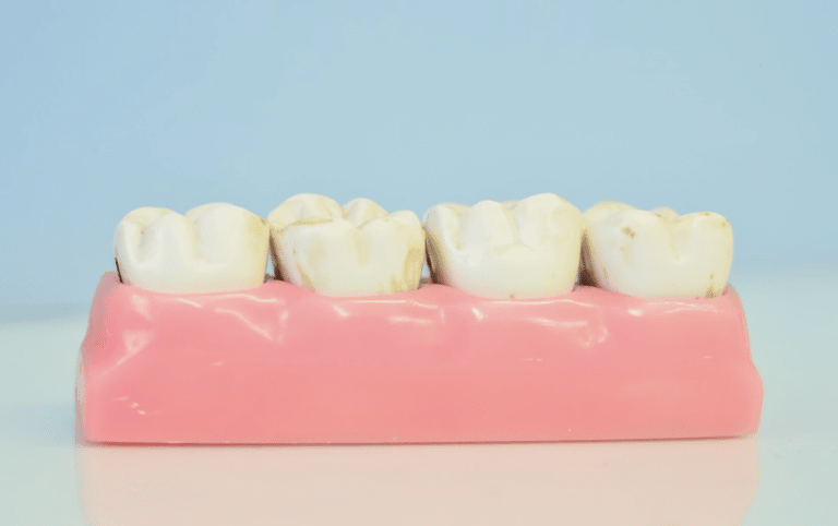 The Most Common Causes of Teeth Discoloration