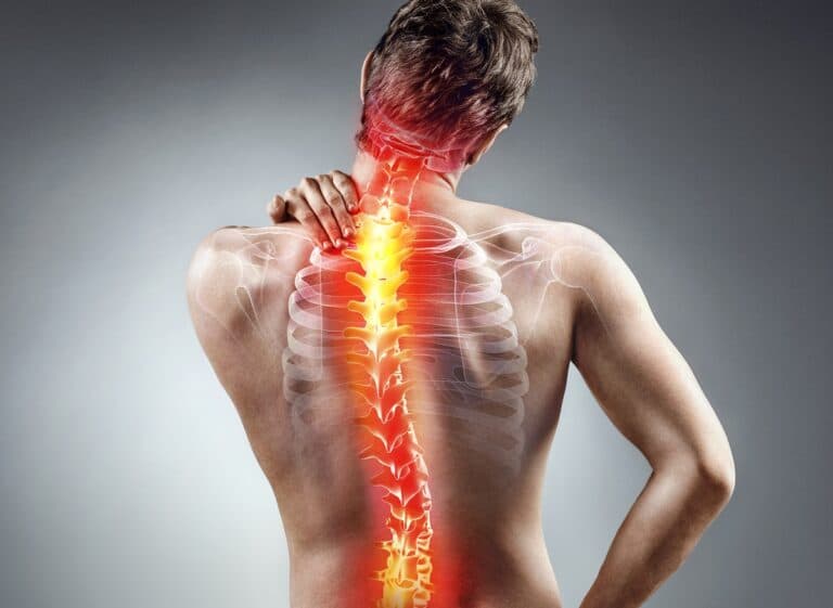 6 Things To Know About Adult Scoliosis