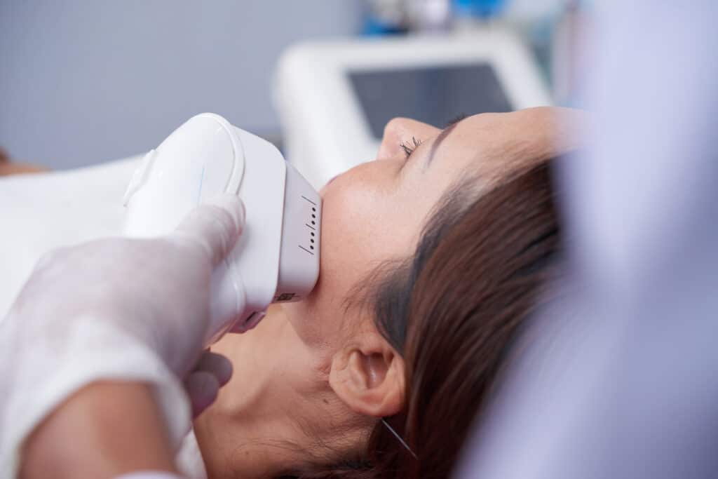 laser hair removal