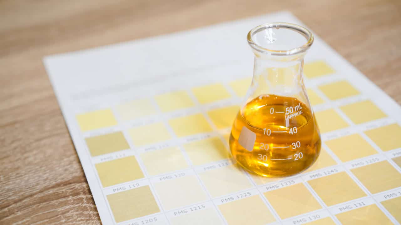 a flask with urine medical analyzes concept diag 2023 03 13 18 50 23 utc
