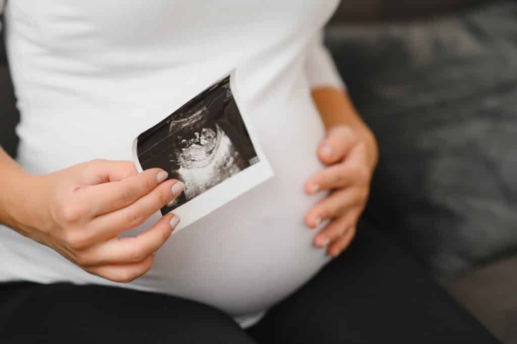 pregnant women holding echo pictures in hand
