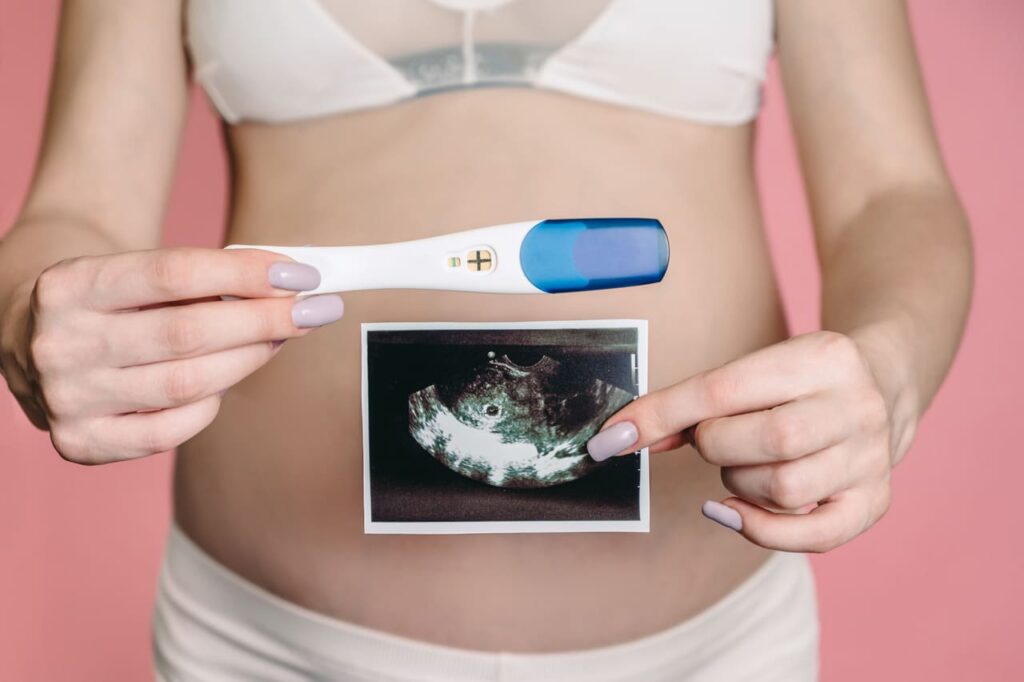 a happy expectant mother shows an ultrasound image 2023 11 27 05 20 03 utc