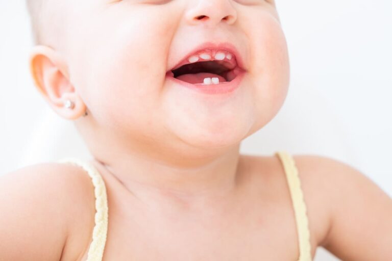 How to Tell if Baby Will Have Gap Teeth