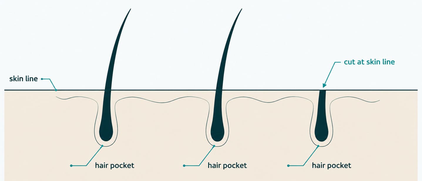 Hair shaft and skin-pocket diagram with a labelled skin line